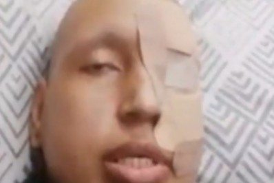 Polícia investiga mulher que teria forjado doença terminal para receber doações