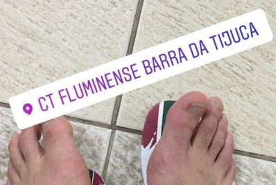 Meia do Fluminense mostra tornozelo inchado e diz que jogou com dor: 'Queria ajudar'