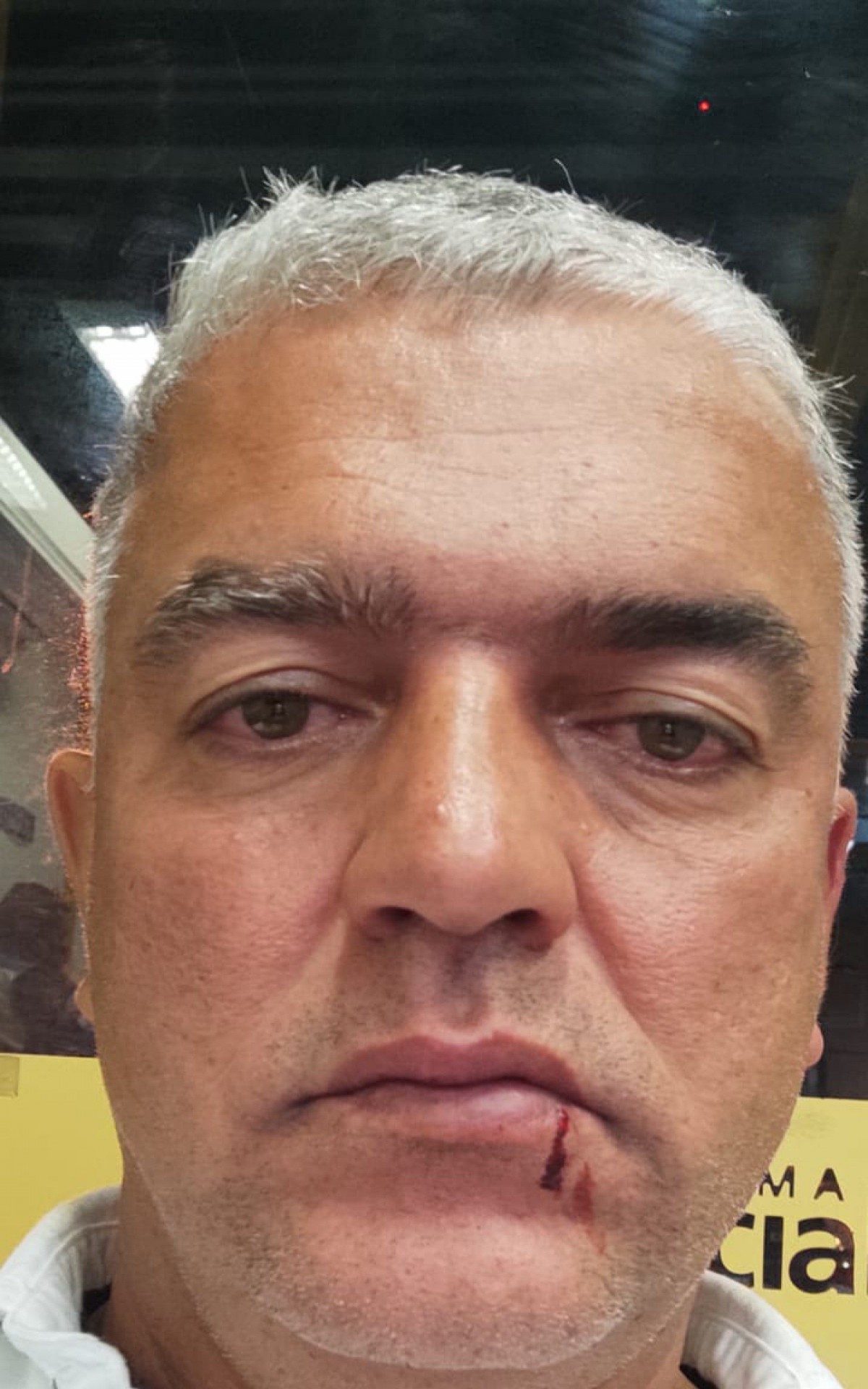 Elvis Dutra levou um soco na boca do subtenente do Corpo de Bombeiros