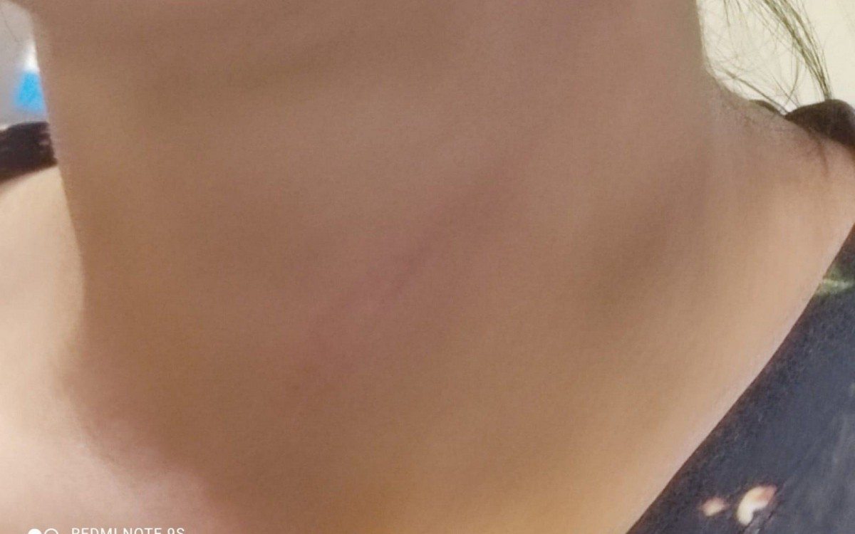 Mulher recebeu um "golpe de gravata" do subtenente do Corpo de Bombeiros