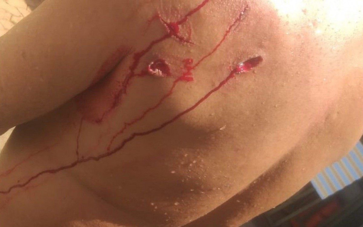 Homem &eacute; mordido por Capivara enquando nadava em Bras&iacute;lia
