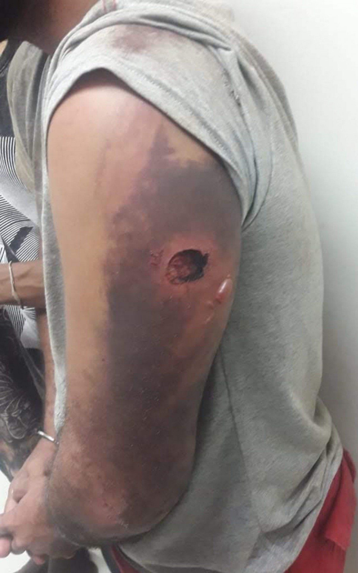 Jefferson Rangel relata ter sofrido agressões e tortura de militares do Exército na Vila Cruzeiro