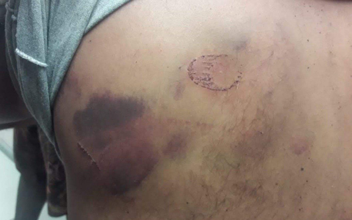 Jefferson Rangel relata ter sofrido agressões e tortura de militares do Exército na Vila Cruzeiro