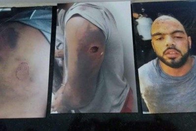  Defensoria Pública: 1.250 presos relatam agressões e tortura 