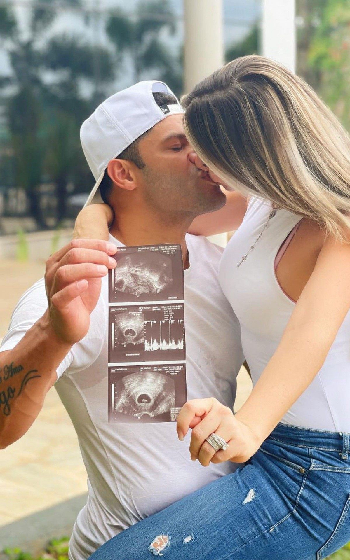 Hulk e Camila Ângelo anunciam que vão ser papais