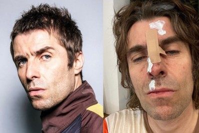 Liam Gallagher, da banda Oasis, cai de helicóptero após show na Inglaterra