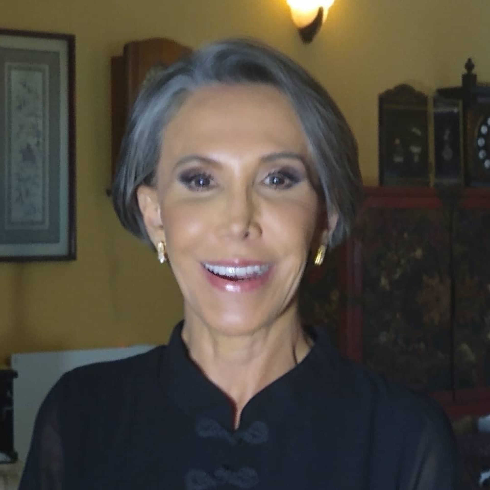 Atriz exibe hematoma causado por queda - Reprodução