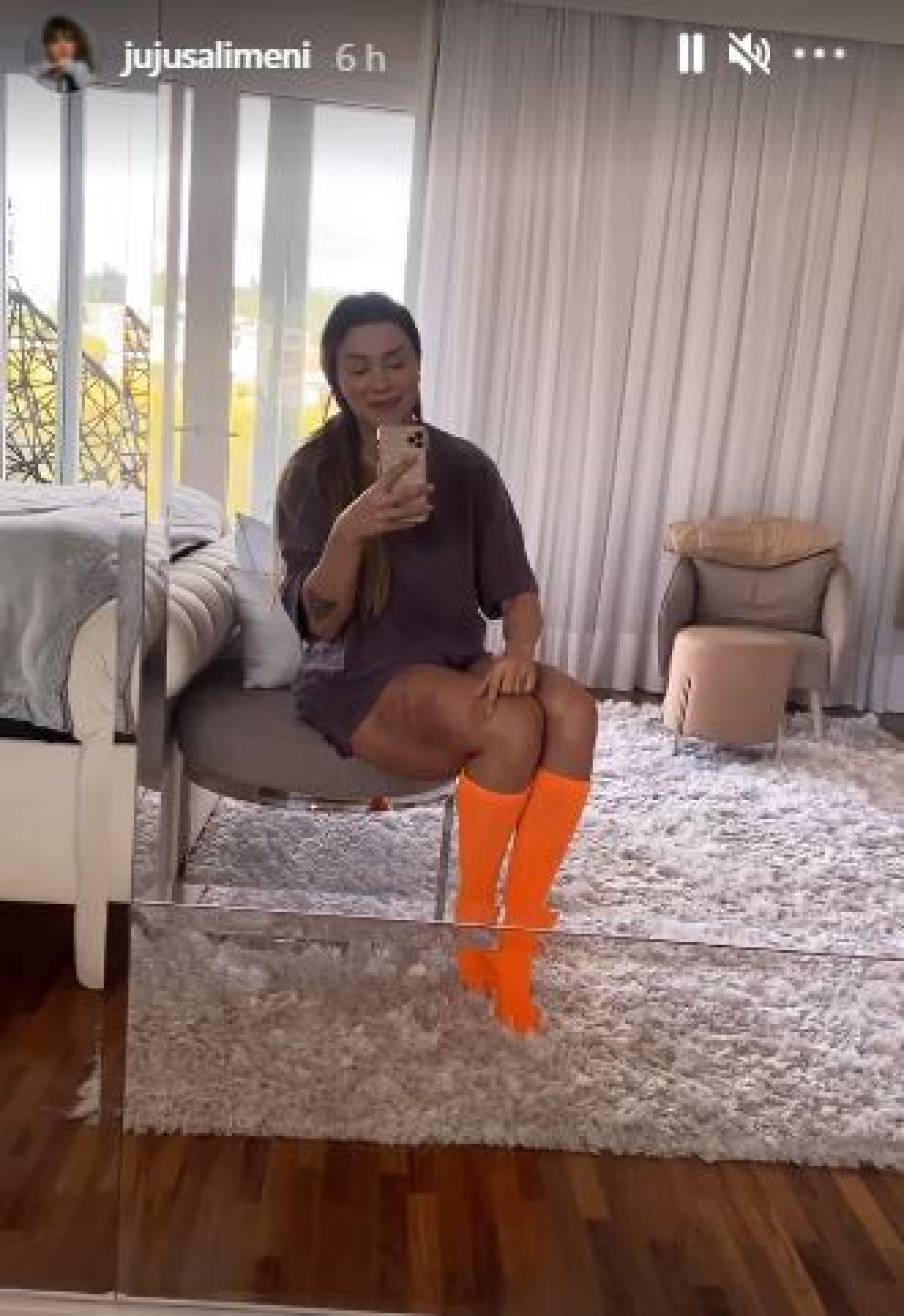 Juju Salimeni mostra hematomas no corpo - Reprodução