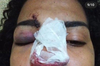 Mulher abriga criança abandonada em Belford Roxo e é agredida pelo pai com soco inglês