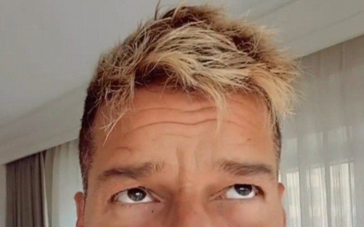 Ricky Martin nega procedimentos no rosto