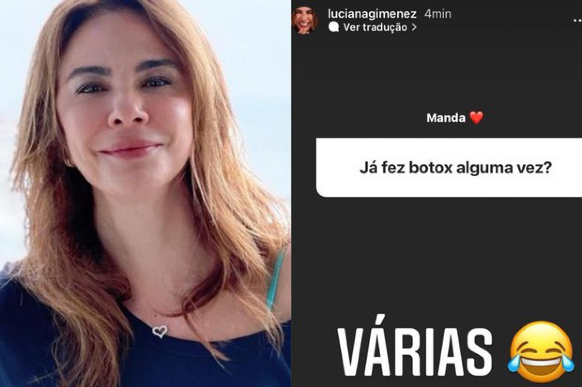 Luciana Gimenez fala sobre botox nas redes sociais - Reprodução Internet