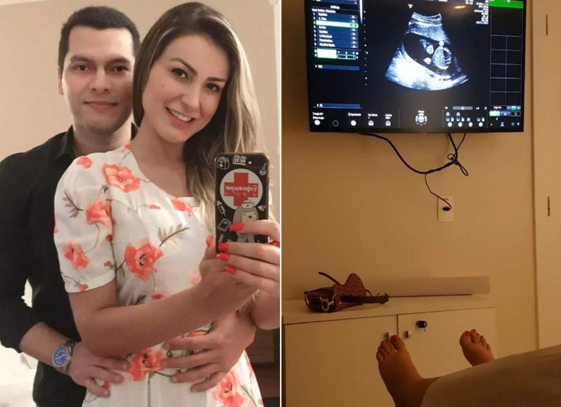 Thiago Lopes e Andressa Urach no médico para fazer ultrassom - Reprodução Internet