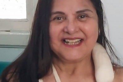 Atriz cai no quintal de casa e quebra os dois antebraços