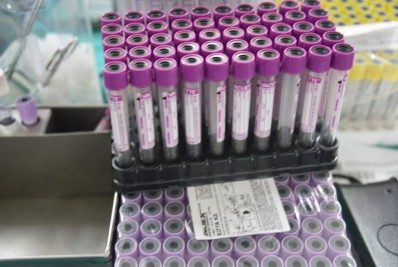 Campanha de doação de sangue em Maricá coletou 120 bolsas