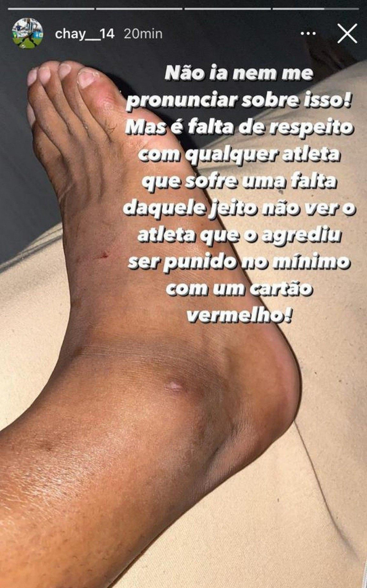 Chay desabafou e criticou a dura entrada de Caio Vin&iacute;cius que o fez deixar o jogo contra a Goi&aacute;s de maca e &agrave;s l&aacute;grimas