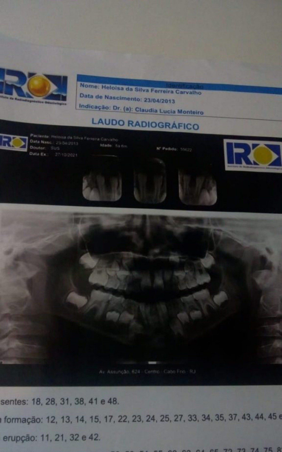 Segundo a m&atilde;e, a menina foi a consulta para extrair dois dentes de leite, diferente dos dois incisivos centrais permanentes 