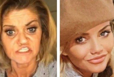 Atriz que teve rosto corroído por cocaína faz plásticas e resultado impressiona