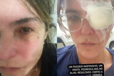 Durante caminhada, Cristiana Oliveira sofre acidente inusitado: 'Um passeio inofensivo'