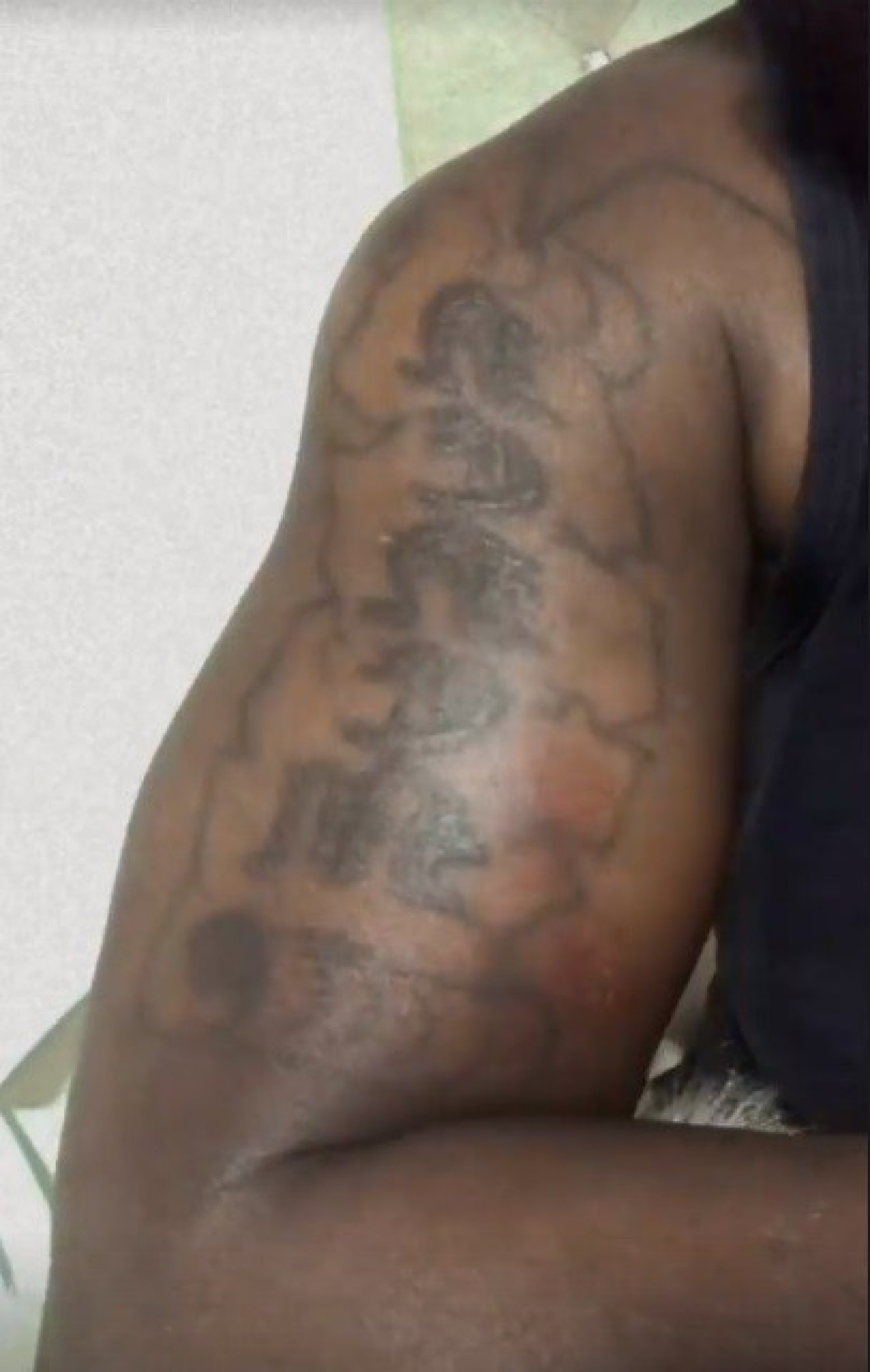 Criminoso machuca o bra&ccedil;o de Nen&eacute;m, da dupla com Pep&ecirc;' - reprodu&ccedil;&atilde;o do instagram