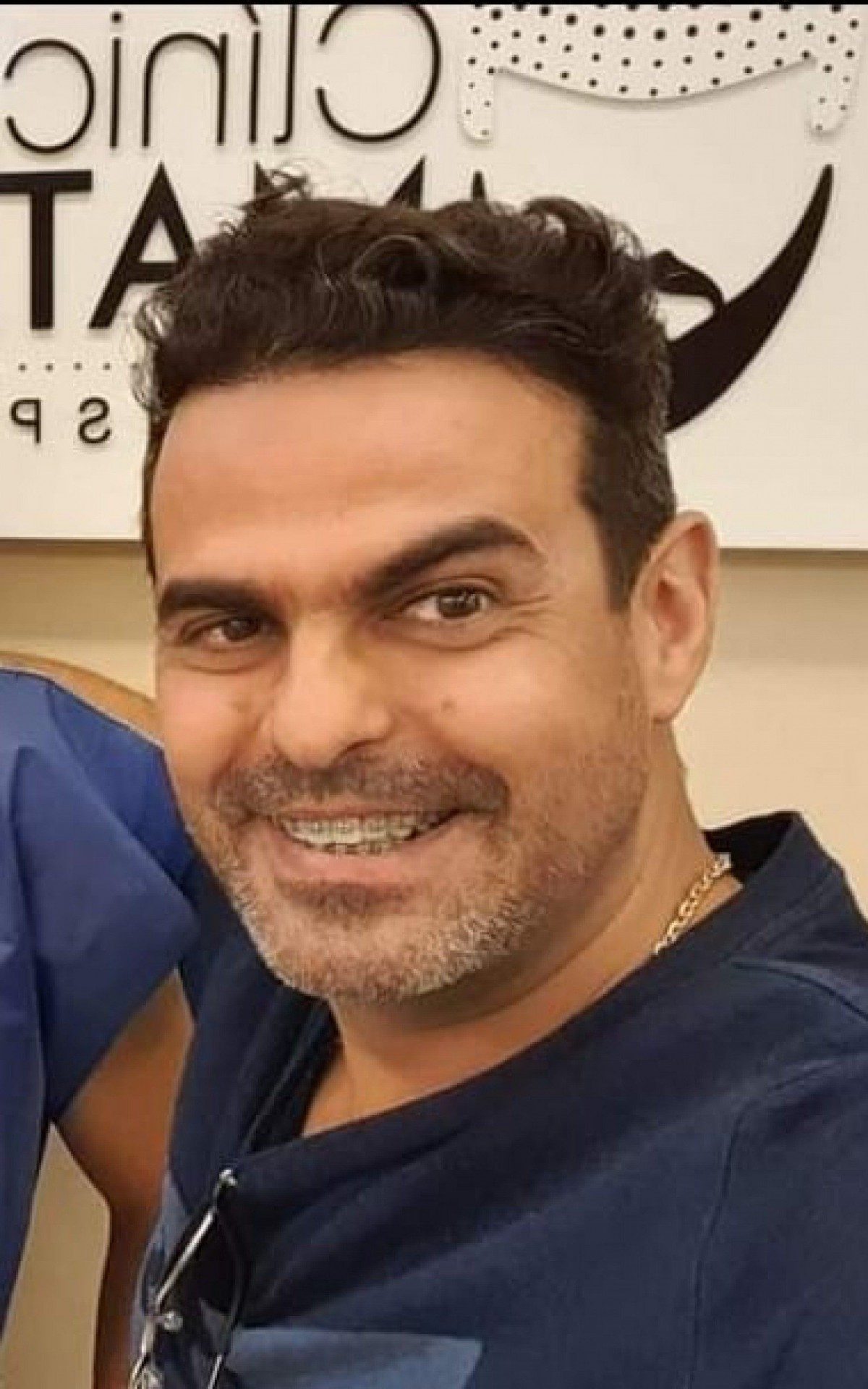 Alex Matarazzo com o tratamento capilar em sua cl&iacute;nica