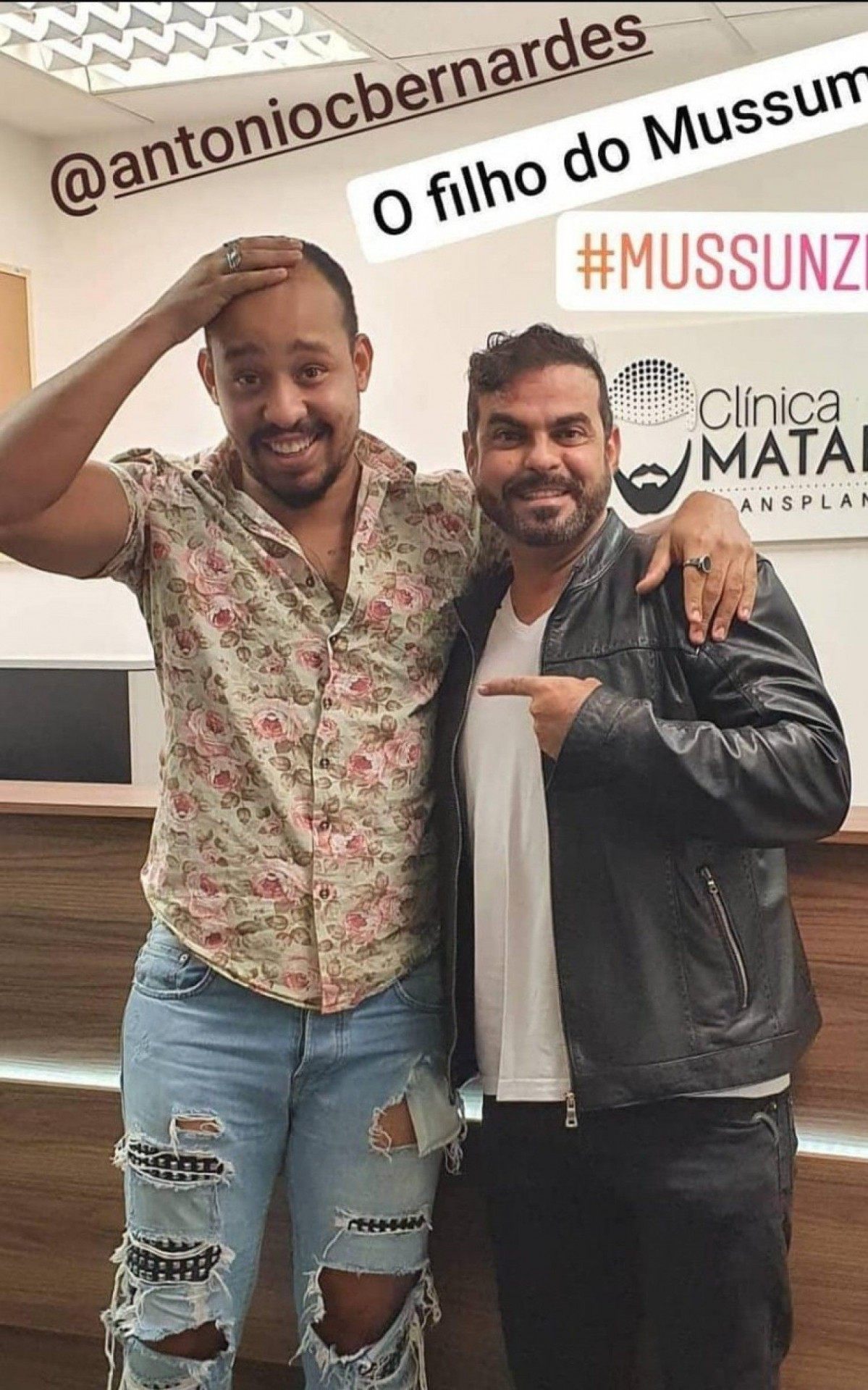 O ator Mussunzinho, que fez o tratamento, com Alex Matarazzo