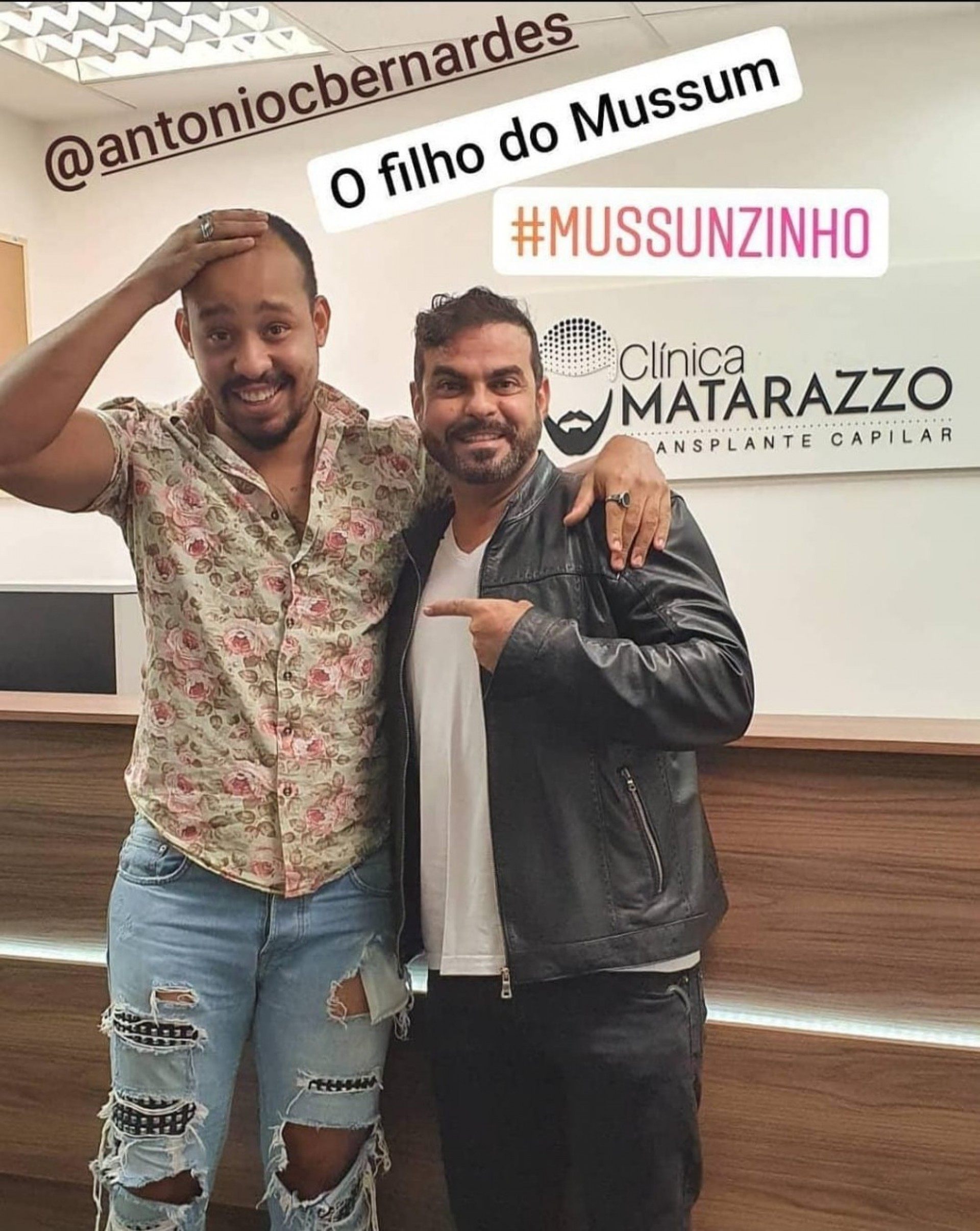 O ator Mussunzinho, que fez o tratamento, com Alex Matarazzo - Divulgação