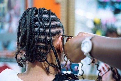 Cidade tem novos casos de problemas oftalmológicos causados por pomadas modeladoras de trança