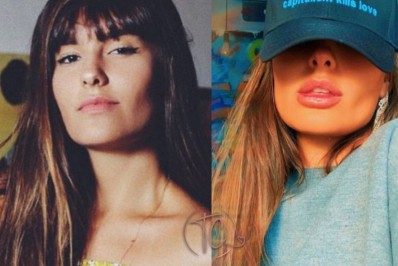 Mudou muito? Ex-BBB Thais Braz mostra antes e depois de preenchimento labial