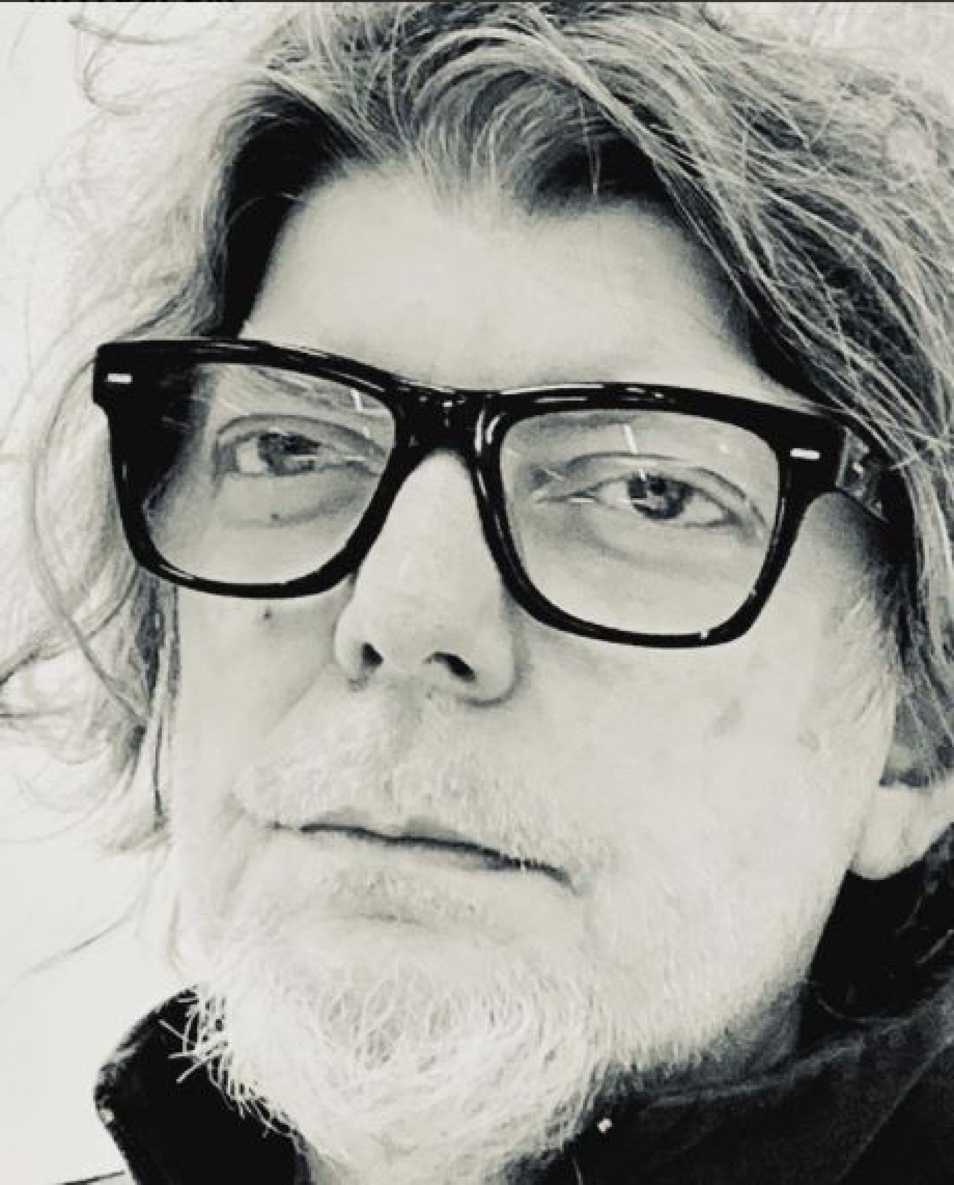 O vocalista repostou a nota sobre a cirurgia em seu perfil oficial - Reprodução