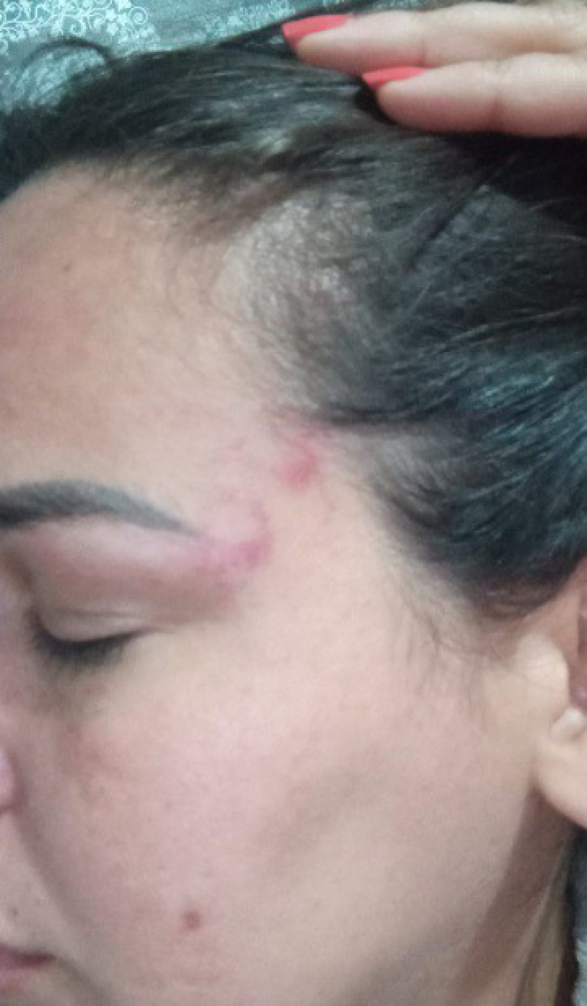 Fernanda Rodrigues mostra agressões - Reprodução