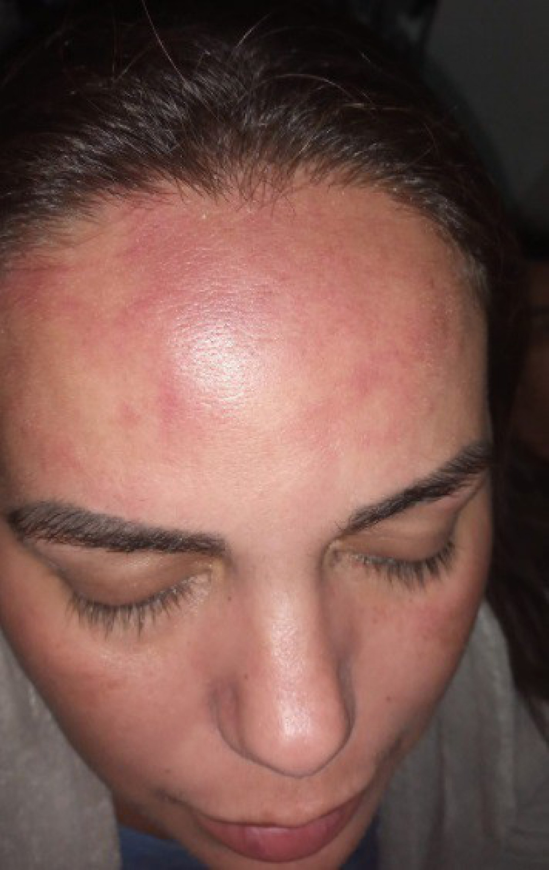 Fernanda Rodrigues mostra agressões - Reprodução