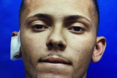 'Descontrolado e alcoolizado', diz jovem esfaqueada pelo irmão