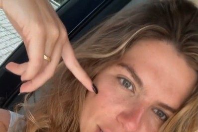 'Esturriquei', brinca Mariana Goldfarb após dia de sol sem protetor solar