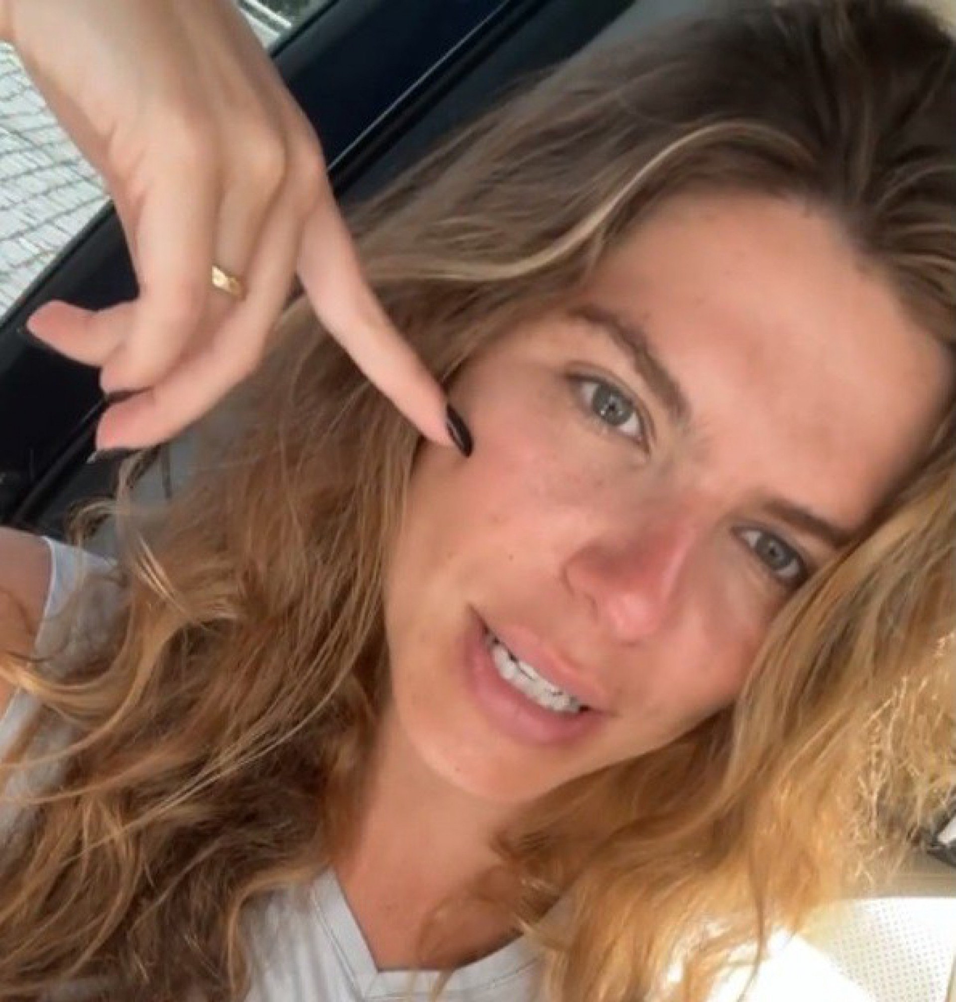 Modelo falou sobre marcas de sol após esquecer protetor solar  - Reprodução/Instagram