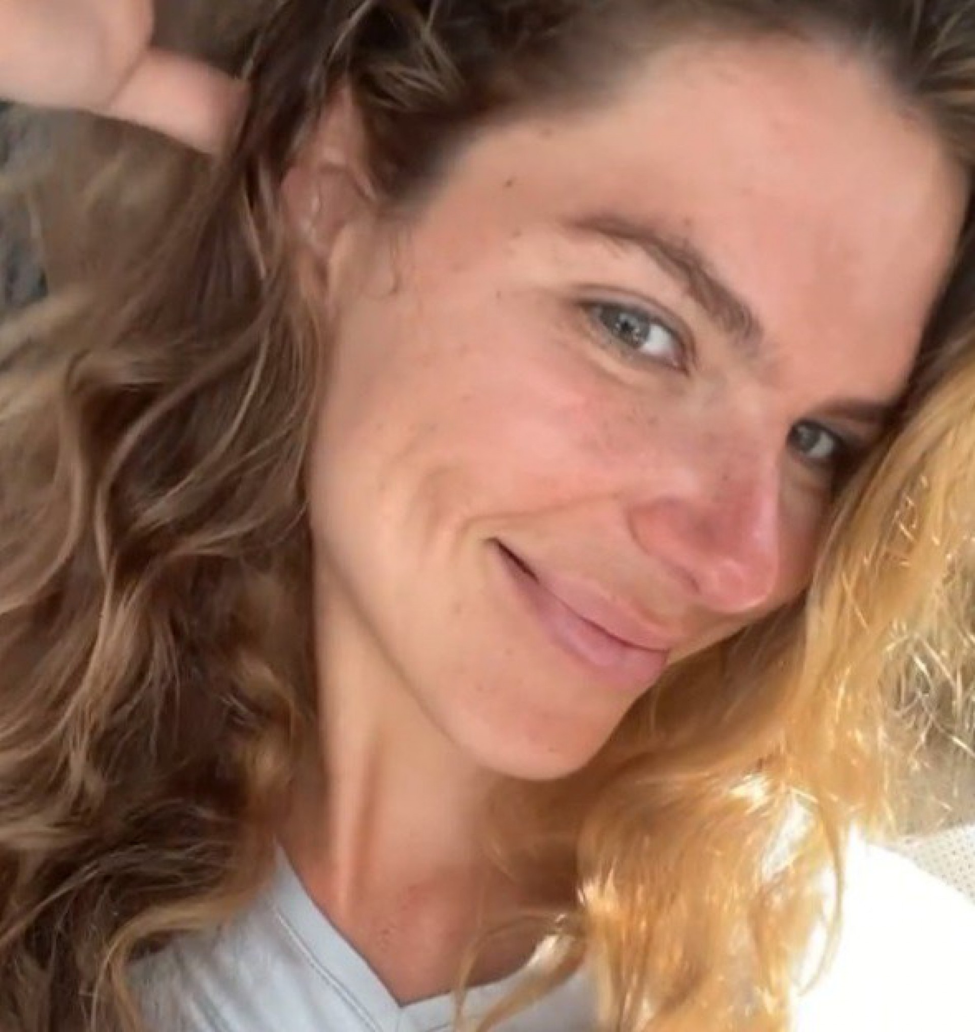 Modelo falou sobre marcas de sol após esquecer protetor solar  - Reprodução/Instagram