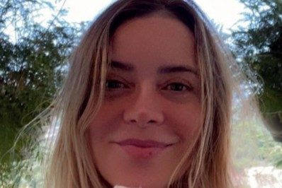 Christine Fernandes sofre fratura exposta no dedo