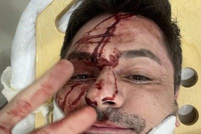 Irmão de Rodrigo Faro sofre acidente de carro e fratura duas costelas