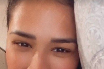 Após perder 12kg, Simone faz cirurgia plástica: 'Era algo que eu queria muito'