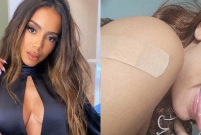 Anitta toma reforço da vacina e alfineta Jair Bolsonaro: 'Será que viro jacaré?'