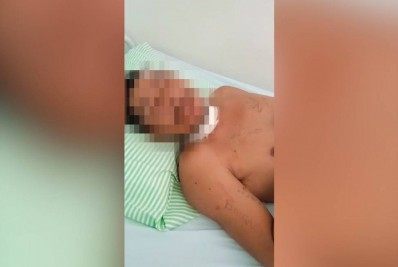 Indígena escapa da morte após ser esfaqueado e enterrado