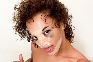 Pabllo Vittar mostra rosto inchado e com curativos após procedimento cirúrgico