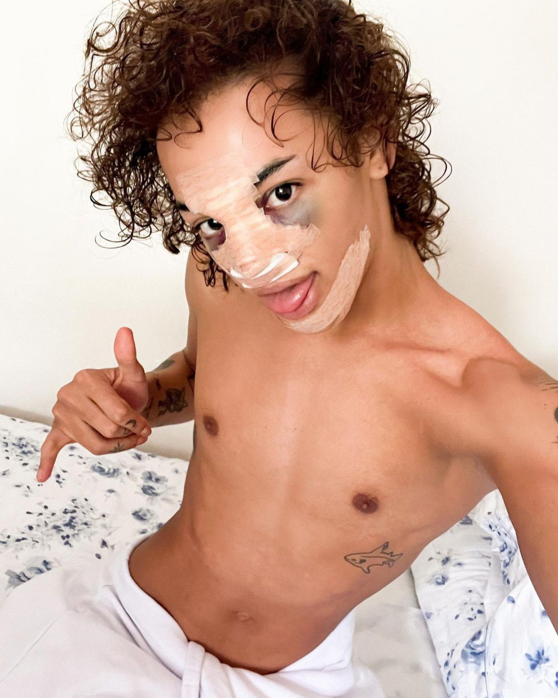 Pabllo Vittar compartilha foto após procedimento cirúrgico  - Reprodução/Instagram