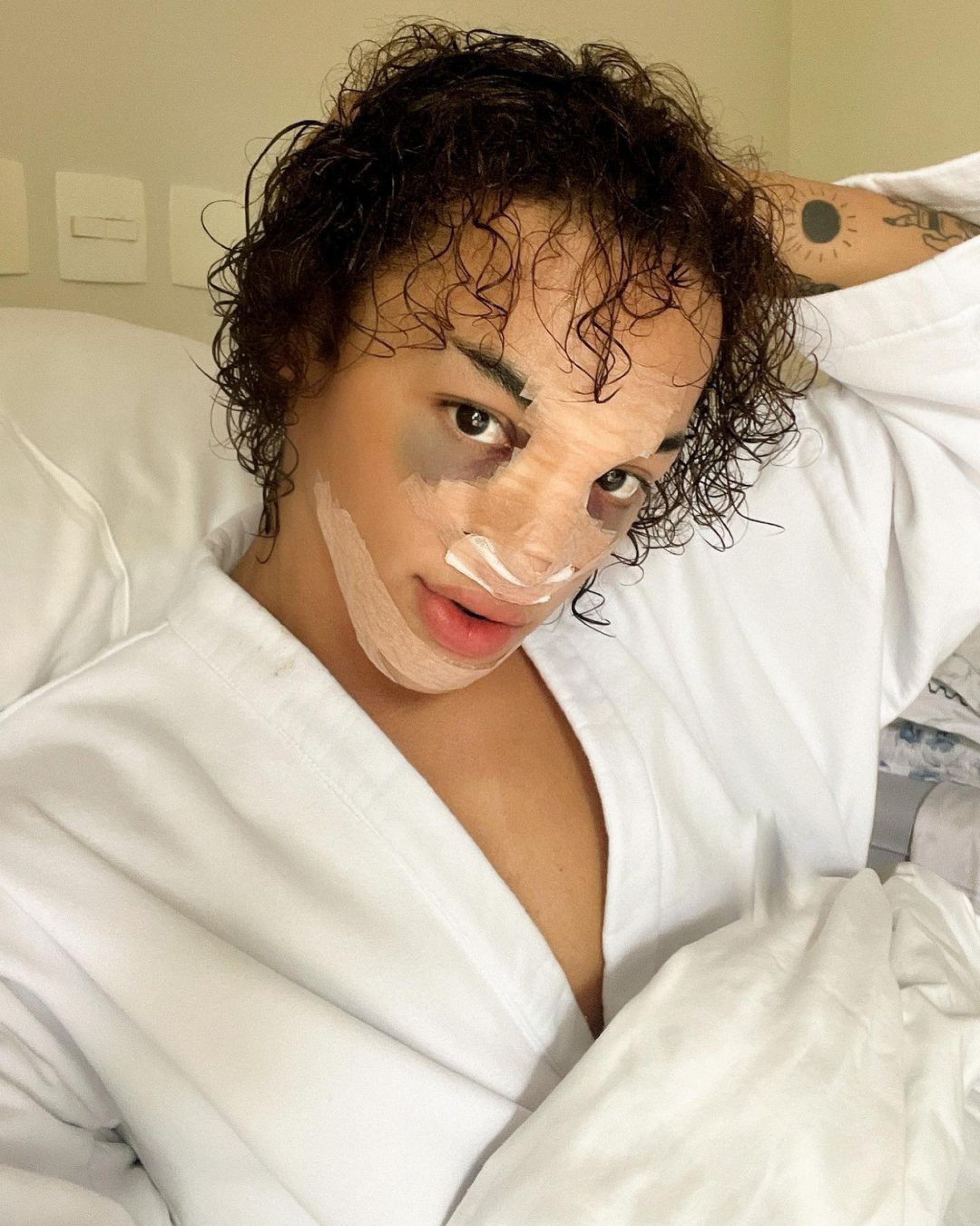 Pabllo Vittar compartilha foto após procedimento cirúrgico  - Reprodução/Instagram