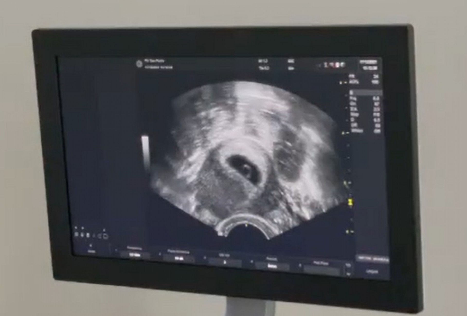 Tays Reis e Biel esperam o primeiro filho - reprodução do instagram