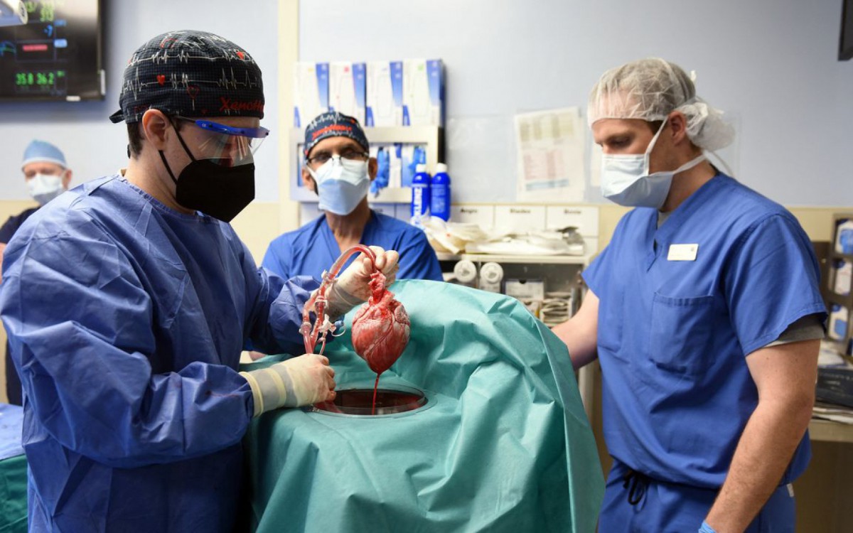 Homem recebe coração de porco durante transplante - AFP