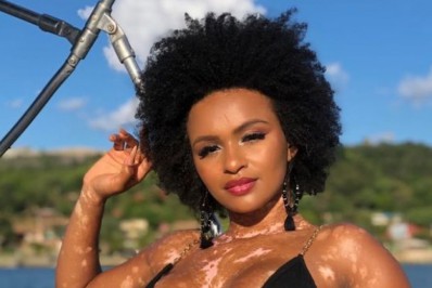 'Sei o peso de ser uma mulher preta, com vitiligo e gostosa', diz Natália, do 'BBB 22'