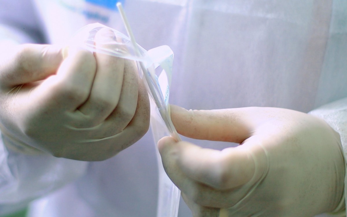 Desde a semana passada, a Secretaria de Sa&uacute;de iniciou a testagem r&aacute;pida com cotonete (ant&iacute;geno por swab), cujo resultado sai ap&oacute;s 20 minutos