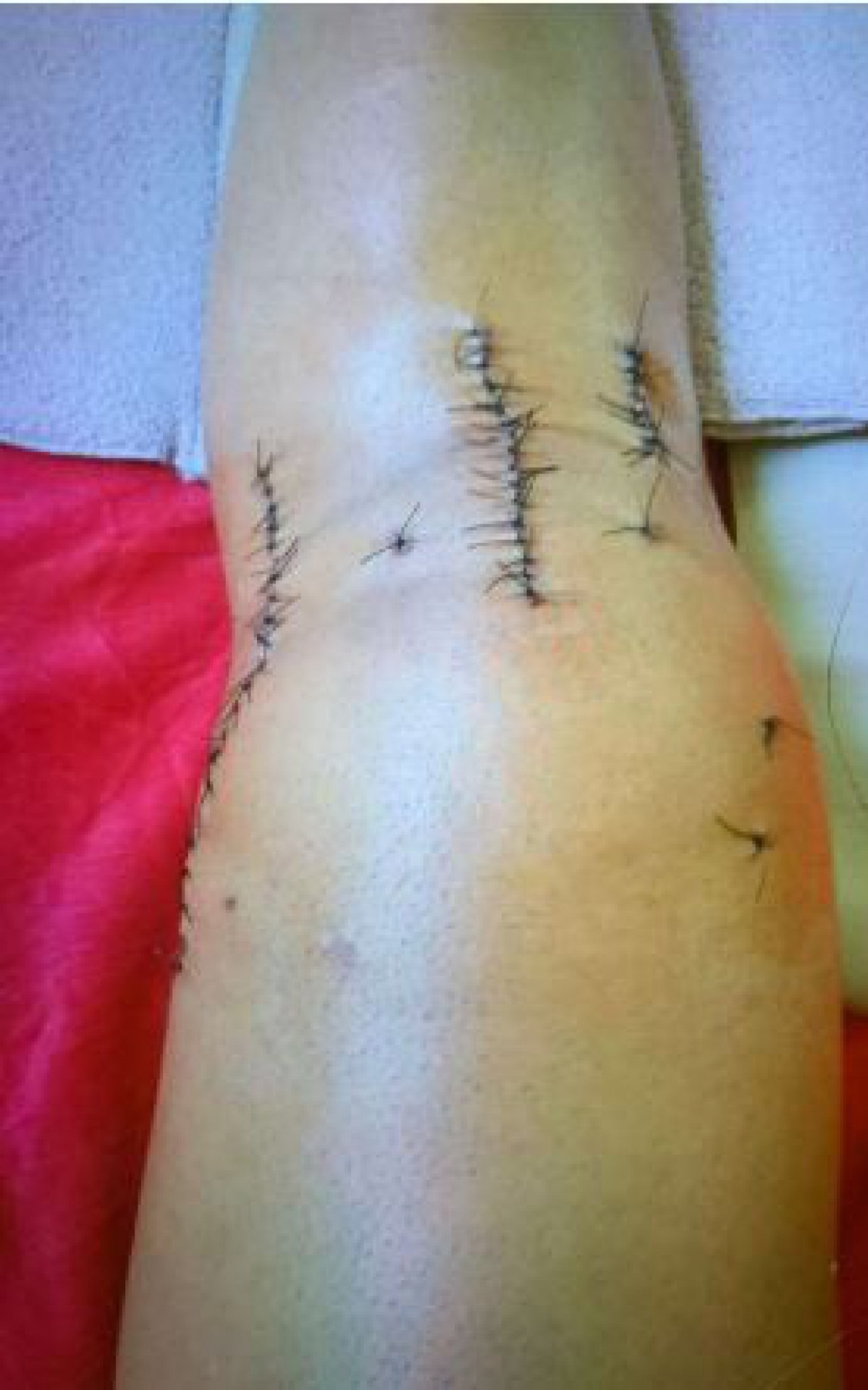 Essa &eacute; uma das imagens do joelho de Gustavo que foi anexada ao processo