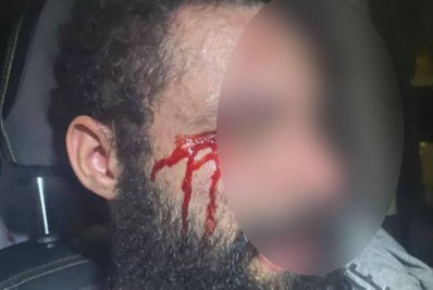 Condenada por mandar cortar pênis do ex, médica é investigada por agredir e torturar marido