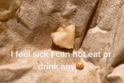 Cliente fica em choque ao descobrir dente no 'recheio' de sanduíche em lanchonete 